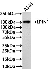 Western Blot
Positive WB detected in: A549 whole cell lysate(30µg) 
All lanes: LPIN1 antibody at 1:1000
Secondary
Goat polyclonal to rabbit IgG at 1/40000 dilution
Predicted band size: 99 kDa
Observed band size: 130 kDa
Exposure time：3min