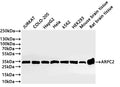 Western Blot
Positive WB detected in: JURKAT whole cell lysate(30µg) , COLO-205 whole cell lysate(30µg) , HepG2 whole cell lysate(30µg) , Hela whole cell lysate(30µg) , K562 whole cell lysate(30µg) , HEK293 whole cell lysate(30µg) , Mouse brain tissue lysate(20µg) , Rat brain tissue lysate(20µg) 
All lanes: ARPC2 antibody at 1:1000
Secondary
Goat polyclonal to rabbit IgG at 1/40000 dilution
Predicted band size: 34 kDa
Observed band size: 34 kDa
Exposure time：20s