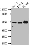 Western Blot
Positive WB detected in: MCF-7 whole cell lysate, THP-1 whole cell lysate, HL-60 whole cell lysate
All lanes: Vitamin D antibody at 1:1000
Secondary
Goat polyclonal to rabbit IgG at 1/50000 dilution
Predicted band size: 49, 54 kDa
Observed band size: 49 kDa