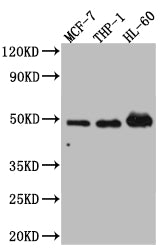 Western Blot
Positive WB detected in: MCF-7 whole cell lysate, THP-1 whole cell lysate, HL-60 whole cell lysate
All lanes: Vitamin D antibody at 1:1000
Secondary
Goat polyclonal to rabbit IgG at 1/50000 dilution
Predicted band size: 49, 54 kDa
Observed band size: 49 kDa