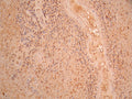 IHC image of CSB-RA945578A0HU diluted at 1:100 and staining in paraffin-embedded human spleen tissue performed on a Leica BondTM system. After dewaxing and hydration, antigen retrieval was mediated by high pressure in a citrate buffer (pH 6.0). Section was blocked with 10% normal goat serum 30min at RT. Then primary antibody (1% BSA) was incubated at 4°C overnight. The primary is detected by a Goat anti-rabbit polymer IgG labeled by HRP and visualized using 0.05% DAB.
