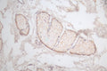 IHC image of CSB-RA945763A0HU diluted at 1:100 and staining in paraffin-embedded human skin tissue performed on a Leica BondTM system. After dewaxing and hydration, antigen retrieval was mediated by high pressure in a citrate buffer (pH 6.0) . Section was blocked with 10% normal goat serum 30min at RT. Then primary antibody (1% BSA) was incubated at 4°C overnight. The primary is detected by a Goat anti-rabbit polymer IgG labeled by HRP and visualized using 0.66% DAB.