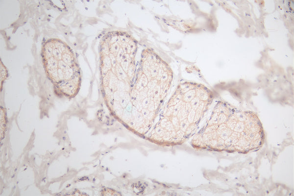IHC image of CSB-RA945763A0HU diluted at 1:100 and staining in paraffin-embedded human skin tissue performed on a Leica BondTM system. After dewaxing and hydration, antigen retrieval was mediated by high pressure in a citrate buffer (pH 6.0) . Section was blocked with 10% normal goat serum 30min at RT. Then primary antibody (1% BSA) was incubated at 4°C overnight. The primary is detected by a Goat anti-rabbit polymer IgG labeled by HRP and visualized using 0.66% DAB.