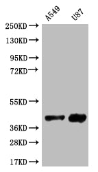 Western Blot
Positive WB detected in: A549 whole cell lysate, U87 whole cell lysate
All lanes: SRR antibody at 1:1000
Secondary
Goat polyclonal to rabbit IgG at 1/50000 dilution
Predicted band size: 37 kDa
Observed band size: 37 kDa