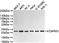 Western Blot
Positive WB detected in: MCF-7 whole cell lysate(30µg) , A431 whole cell lysate(30µg) , PC-3 whole cell lysate(30µg) , HeLa whole cell lysate(30µg) , U-251MG whole cell lysate(30µg) , THP-1 whole cell lysate(30µg) 
All lanes: CAPNS1 antibody at 1:1000
Secondary
Goat polyclonal to rabbit IgG at 1/40000 dilution
Predicted band size: 28 kDa
Observed band size: 28 kDa
Exposure time：2min