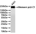 Western Blot
Positive WB detected in: A431 whole cell lysate(30µg) 
All lanes: Niemann pick C1 antibody at 1:1000
Secondary
Goat polyclonal to rabbit IgG at 1/40000 dilution
Predicted band size: 142 kDa kDa
Observed band size: 240 kDa
Exposure time：1min20s