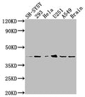 Western Blot
Positive WB detected in: SH-SY5Y whole cell lysate, 293 whole cell lysate, Hela whole cell lysate, U251 whole cell lysate, A549 whole cell lysate, Mouse brain tissue
All lanes: OPRD1 antibody at 1:2000
Secondary
Goat polyclonal to rabbit IgG at 1/50000 dilution
Predicted band size: 41 kDa
Observed band size: 41 kDa