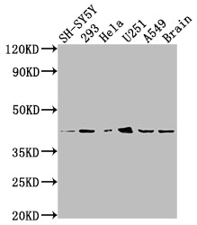 Western Blot
Positive WB detected in: SH-SY5Y whole cell lysate, 293 whole cell lysate, Hela whole cell lysate, U251 whole cell lysate, A549 whole cell lysate, Mouse brain tissue
All lanes: OPRD1 antibody at 1:2000
Secondary
Goat polyclonal to rabbit IgG at 1/50000 dilution
Predicted band size: 41 kDa
Observed band size: 41 kDa