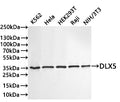 Western Blot
Positive WB detected in: K562 whole cell lysate(30µg) , Hela whole cell lysate(30µg) , HEK293T whole cell lysate(30µg) , Raji whole cell lysate(30µg) , NIH/3T3 whole cell lysate(30µg) 
All lanes: DLX5 antibody at 1:1000
Secondary
Goat polyclonal to rabbit IgG at 1/40000 dilution
Predicted band size: 32 kDa
Observed band size: 35 kDa
Exposure time：2min