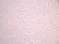 IHC image of CSB-RA949479A0HU diluted at 1:100 and staining in paraffin-embedded human brain tissue performed on a Leica BondTM system. After dewaxing and hydration, antigen retrieval was mediated by high pressure in a citrate buffer (pH 6.0). Section was blocked with 10% normal goat serum 30min at RT. Then primary antibody (1% BSA) was incubated at 4°C overnight. The primary is detected by a Goat anti-rabbit polymer IgG labeled by HRP and visualized using 0.05% DAB.