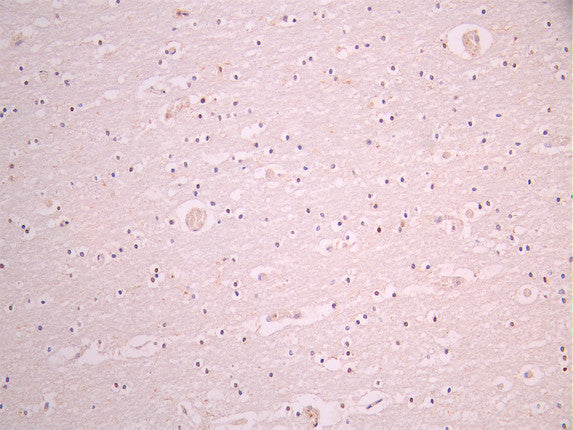 IHC image of CSB-RA949479A0HU diluted at 1:100 and staining in paraffin-embedded human brain tissue performed on a Leica BondTM system. After dewaxing and hydration, antigen retrieval was mediated by high pressure in a citrate buffer (pH 6.0). Section was blocked with 10% normal goat serum 30min at RT. Then primary antibody (1% BSA) was incubated at 4°C overnight. The primary is detected by a Goat anti-rabbit polymer IgG labeled by HRP and visualized using 0.05% DAB.