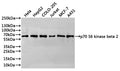 Western Blot
Positive WB detected in: Hela whole cell lysate(30µg), HepG2 whole cell lysate(30µg), COLO-205 whole cell lysate(30µg), Jurkat whole cell lysate(30µg), MCF-7 whole cell lysate(30µg), A431 whole cell lysate(30µg)
All lanes: p70 S6 kinase beta 2 antibody at 1:1000
Secondary
Goat polyclonal to rabbit IgG at 1/40000 dilution
Predicted band size: 53 kDa
Observed band size: 63 kDa
Exposure time：2min