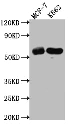 Western Blot
Positive WB detected in: MCF-7 whole cell lysate, K562 whole cell lysate
All lanes: HDAC2 antibody at 1:1000
Secondary
Goat polyclonal to rabbit IgG at 1/50000 dilution
Predicted band size: 56, 52 kDa
Observed band size: 60 kDa