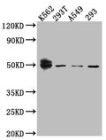 Western Blot
Positive WB detected in: K562 whole cell lysate, 293T whole cell lysate, A549 whole cell lysate, HEK293 whole cell lysate
All lanes: Wilms Tumor Protein antibody at 1:1000
Secondary
Goat polyclonal to rabbit IgG at 1/50000 dilution
Predicted band size: 50, 48, 48, 49, 35, 57, 56, 34 kDa
Observed band size: 50 kDa
