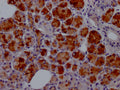 IHC image of CSB-RA950380A0HU diluted at 1:100 and staining in paraffin-embedded human salivary gland tissue performed on a Leica BondTM system. After dewaxing and hydration, antigen retrieval was mediated by high pressure in a citrate buffer (pH 6.0) . Section was blocked with 10% normal goat serum 30min at RT. Then primary antibody (1% BSA) was incubated at 4℃ overnight. The primary is detected by a Goat anti-rabbit IgG polymer labeled by HRP and visualized using 0.05% DAB.