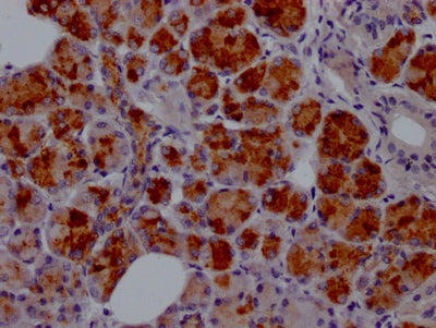IHC image of CSB-RA950380A0HU diluted at 1:100 and staining in paraffin-embedded human salivary gland tissue performed on a Leica BondTM system. After dewaxing and hydration, antigen retrieval was mediated by high pressure in a citrate buffer (pH 6.0) . Section was blocked with 10% normal goat serum 30min at RT. Then primary antibody (1% BSA) was incubated at 4℃ overnight. The primary is detected by a Goat anti-rabbit IgG polymer labeled by HRP and visualized using 0.05% DAB.