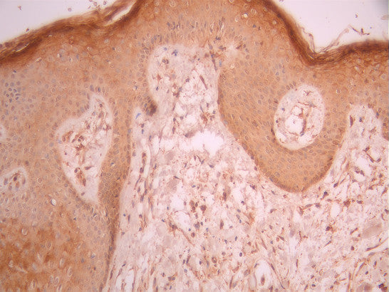 IHC image of CSB-RA950918A0HU diluted at 1:100 and staining in paraffin-embedded human skin tissue performed on a Leica BondTM system. After dewaxing and hydration, antigen retrieval was mediated by high pressure in a citrate buffer (pH 6.0). Section was blocked with 10% normal goat serum 30min at RT. Then primary antibody (1% BSA) was incubated at 4°C overnight. The primary is detected by a Goat anti-rabbit polymer IgG labeled by HRP and visualized using 0.05% DAB.