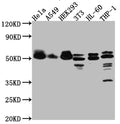 Western Blot
Positive WB detected in: Hela whole cell lysate, A549 whole cell lysate, HEK293 whole cell lysate, NIH/3T3 whole cell lysate, HL-60 whole cell lysate, THP-1 whole cell lysate
All lanes: MAPKAPK2 antibody at 1:1000
Secondary
Goat polyclonal to rabbit IgG at 1/50000 dilution
Predicted band size: 46, 43 kDa
Observed band size: 50 kDa