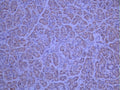 IHC image of CSB-RA952249A0HU diluted at 1:100 and staining in paraffin-embedded human pancreatic tissue performed on a Leica BondTM system. After dewaxing and hydration, antigen retrieval was mediated by high pressure in a citrate buffer (pH 6.0). Section was blocked with 10% normal goat serum 30min at RT. Then primary antibody (1% BSA) was incubated at 4°C overnight. The primary is detected by a Goat anti-rabbit polymer IgG labeled by HRP and visualized using 0.05% DAB.