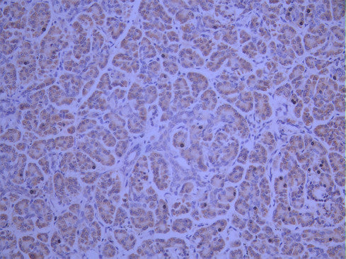 IHC image of CSB-RA952249A0HU diluted at 1:100 and staining in paraffin-embedded human pancreatic tissue performed on a Leica BondTM system. After dewaxing and hydration, antigen retrieval was mediated by high pressure in a citrate buffer (pH 6.0). Section was blocked with 10% normal goat serum 30min at RT. Then primary antibody (1% BSA) was incubated at 4°C overnight. The primary is detected by a Goat anti-rabbit polymer IgG labeled by HRP and visualized using 0.05% DAB.