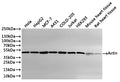 Western Blot
Positive WB detected in: Hela whole cell lysate(30µg), HepG2 whole cell lysate(30µg), MCF-7 whole cell lysate(30µg), A431 whole cell lysate(30µg), COLO-205 whole cell lysate(30µg), Jurkat whole cell lysate(30µg), HEK293 whole cell lysate(30µg), Mouse heart tissue lysate(30µg), Rat heart tissue lysate(30µg)
All lanes: Actin antibody at 1:1000
Secondary
Goat polyclonal to rabbit IgG at 1/40000 dilution
Predicted band size: 42 kDa
Observed band size: 42 kDa
Exposure time：1min