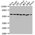 Western Blot
Positive WB detected in: Hela whole cell lysate, HepG2 whole cell lysate, 293 whole cell lysate, Jurkat whole cell lysate, MCF-7 whole cell lysate, K562 whole cell lysate, Mouse brain tissue
All lanes: HSPD1 antibody at 1:2000
Secondary
Goat polyclonal to rabbit IgG at 1/50000 dilution
Predicted band size: 62, 18 kDa
Observed band size: 60 kDa