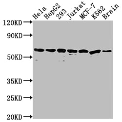 Western Blot
Positive WB detected in: Hela whole cell lysate, HepG2 whole cell lysate, 293 whole cell lysate, Jurkat whole cell lysate, MCF-7 whole cell lysate, K562 whole cell lysate, Mouse brain tissue
All lanes: HSPD1 antibody at 1:2000
Secondary
Goat polyclonal to rabbit IgG at 1/50000 dilution
Predicted band size: 62, 18 kDa
Observed band size: 60 kDa