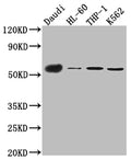 Western Blot
Positive WB detected in: Daudi whole cell lysate, HL-60 whole cell lysate, THP-1 cell lysate, K562 cell lysate
All lanes: CD27 antibody at 1:1000
Secondary
Goat polyclonal to rabbit IgG at 1/50000 dilution
Predicted band size: 30 kDa
Observed band size: 55 kDa