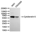 Western Blot, 
Positive WB detected in:A431 whole cell lysate(30µg), COLO205 whole cell lysate(30µg)
All lanes: Cytokeratin 6 antibody at 1:1000
Secondary
Goat polyclonal to rabbit IgG at 1/40000 dilution
Predicted band size: 60 kDa
Observed band size: 60 kDa
Exposure time：60s