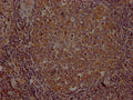 IHC image of CSB-RA954682A0HU diluted at 1:100 and staining in paraffin-embedded human lymph node tissue performed on a Leica BondTM system. After dewaxing and hydration, antigen retrieval was mediated by high pressure in a citrate buffer (pH 6.0) . Section was blocked with 10% normal goat serum 30min at RT. Then primary antibody (1% BSA) was incubated at 4℃ overnight. The primary is detected by a Goat anti-rabbit IgG polymer labeled by HRP and visualized using 0.05% DAB.