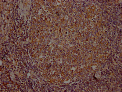 IHC image of CSB-RA954682A0HU diluted at 1:100 and staining in paraffin-embedded human lymph node tissue performed on a Leica BondTM system. After dewaxing and hydration, antigen retrieval was mediated by high pressure in a citrate buffer (pH 6.0) . Section was blocked with 10% normal goat serum 30min at RT. Then primary antibody (1% BSA) was incubated at 4℃ overnight. The primary is detected by a Goat anti-rabbit IgG polymer labeled by HRP and visualized using 0.05% DAB.