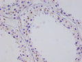 IHC image of CSB-RA955619A0HU diluted at 1:100 and staining in paraffin-embedded human testis tissue performed on a Leica BondTM system. After dewaxing and hydration, antigen retrieval was mediated by high pressure in a citrate buffer (pH 6.0) . Section was blocked with 10% normal goat serum 30min at RT. Then primary antibody (1% BSA) was incubated at 4°C overnight. The primary is detected by a Goat anti-rabbit polymer IgG labeled by HRP and visualized using 0.05% DAB.