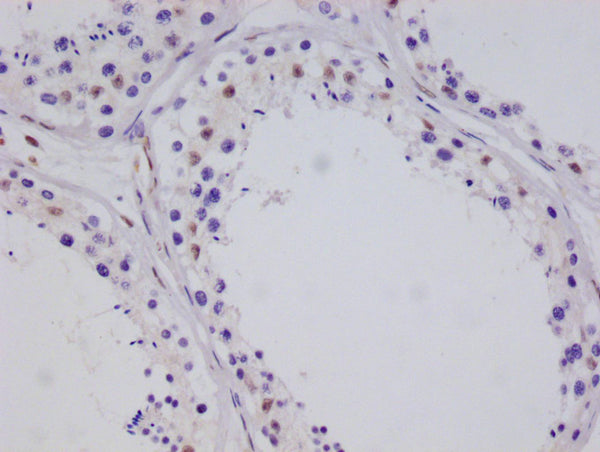 IHC image of CSB-RA955619A0HU diluted at 1:100 and staining in paraffin-embedded human testis tissue performed on a Leica BondTM system. After dewaxing and hydration, antigen retrieval was mediated by high pressure in a citrate buffer (pH 6.0) . Section was blocked with 10% normal goat serum 30min at RT. Then primary antibody (1% BSA) was incubated at 4°C overnight. The primary is detected by a Goat anti-rabbit polymer IgG labeled by HRP and visualized using 0.05% DAB.