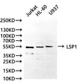 Western Blot, 
Positive WB detected in:Jurkat whole cell lysate(30µg), HL-60 whole cell lysate(30µg), U937 whole cell lysate(30µg)
All lanes: LSP1 antibody at 1:1000
Secondary
Goat polyclonal to rabbit IgG at 1/40000 dilution
Predicted band size: 37 kDa
Observed band size:52 kDa
Exposure time：180s
