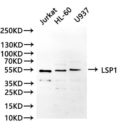 Western Blot, 
Positive WB detected in:Jurkat whole cell lysate(30µg), HL-60 whole cell lysate(30µg), U937 whole cell lysate(30µg)
All lanes: LSP1 antibody at 1:1000
Secondary
Goat polyclonal to rabbit IgG at 1/40000 dilution
Predicted band size: 37 kDa
Observed band size:52 kDa
Exposure time：180s