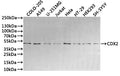 Western Blot
Positive WB detected in: COLO-205 whole cell lysate(30µg), A549 whole cell lysate(30µg), U-251MG whole cell lysate(30µg), Jurkat whole cell lysate(30µg), Hela whole cell lysate(30µg), HT-29 whole cell lysate(30µg), HEK293 whole cell lysate(30µg), SH-SY5Y whole cell lysate(30µg)
All lanes: CDX2 antibody at 1:1000
Secondary
Goat polyclonal to rabbit IgG at 1/40000 dilution
Predicted band size: 34 kDa
Observed band size: 38 kDa
Exposure time：3min