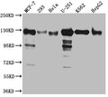 Western Blot
Positive WB detected in: MCF-7 whole cell lysate, 293 whole cell lysate, Hela whole cell lysate, U-251 whole cell lysate, K562 whole cell lysate, HepG2 whole cell lysat
All lanes: Eg5 Antibody at 1:1000
Secondary
Goat polyclonal to rabbit IgG at 1/50000 dilution
Predicted band size: 120 kDa
Observed band size: 130 kDa