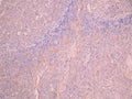 IHC image of CSB-RA957044A0HU diluted at 1:100 and staining in paraffin-embedded human tonsil tissue performed on a Leica BondTM system. After dewaxing and hydration, antigen retrieval was mediated by high pressure in a citrate buffer (pH 6.0). Section was blocked with 10% normal goat serum 30min at RT. Then primary antibody (1% BSA) was incubated at 4°C overnight. The primary is detected by a Goat anti-rabbit polymer IgG labeled by HRP and visualized using 0.05% DAB.