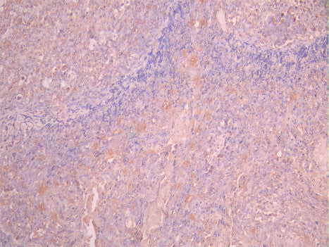 IHC image of CSB-RA957044A0HU diluted at 1:100 and staining in paraffin-embedded human tonsil tissue performed on a Leica BondTM system. After dewaxing and hydration, antigen retrieval was mediated by high pressure in a citrate buffer (pH 6.0). Section was blocked with 10% normal goat serum 30min at RT. Then primary antibody (1% BSA) was incubated at 4°C overnight. The primary is detected by a Goat anti-rabbit polymer IgG labeled by HRP and visualized using 0.05% DAB.