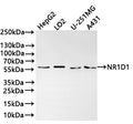 Western Blot
Positive WB detected in:  HepG2 whole cell lysate(30µg) , LO2 whole cell lysate(30µg) , U-251MG whole cell lysate(30µg) , A431 whole cell lysate(30µg) 
All lanes: NR1D1 antibody at 1:1000
Secondary
Goat polyclonal to rabbit IgG at 1/40000 dilution
Predicted band size: 67 kDa
Observed band size: 58 kDa
Exposure time：2min