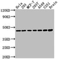 MAP2K1 Antibody – Figure 1 of 3