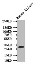 Western Blot
Positive WB detected in: Mouse Kidney tissue lysate,
All lanes: TPSB2 antibody at 1:1000
Secondary
Goat polyclonal to rabbit IgG at 1/50000 dilution
Predicted band size: 30 kDa
Observed band size: 30 kDa