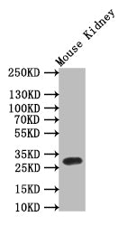 Western Blot
Positive WB detected in: Mouse Kidney tissue lysate,
All lanes: TPSB2 antibody at 1:1000
Secondary
Goat polyclonal to rabbit IgG at 1/50000 dilution
Predicted band size: 30 kDa
Observed band size: 30 kDa