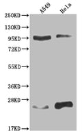 Western Blot
Positive WB detected in: A549 whole cell lysate, Hela whole cell lysate
All lanes: KDM1B antibody at 1:2000
Secondary
Goat polyclonal to rabbit IgG at 1/50000 dilution
Predicted band size: 93, 66, 20 kDa
Observed band size: 90-95, 17-28 kDa