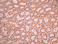 IHC image of CSB-RA958435A0HU diluted at 1:100 and staining in paraffin-embedded human kidney tissue performed on a Leica BondTM system. After dewaxing and hydration, antigen retrieval was mediated by high pressure in a citrate buffer (pH 6.0). Section was blocked with 10% normal goat serum 30min at RT. Then primary antibody (1% BSA) was incubated at 4°C overnight. The primary is detected by a Goat anti-rabbit polymer IgG labeled by HRP and visualized using 0.05% DAB.