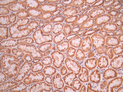 IHC image of CSB-RA958435A0HU diluted at 1:100 and staining in paraffin-embedded human kidney tissue performed on a Leica BondTM system. After dewaxing and hydration, antigen retrieval was mediated by high pressure in a citrate buffer (pH 6.0). Section was blocked with 10% normal goat serum 30min at RT. Then primary antibody (1% BSA) was incubated at 4°C overnight. The primary is detected by a Goat anti-rabbit polymer IgG labeled by HRP and visualized using 0.05% DAB.