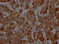 S100A9 Antibody – Figure 1 of 1