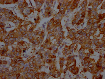 S100A9 Antibody – Figure 1 of 1