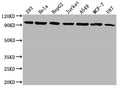 Western Blot
Positive WB detected in: 293 whole cell lysate, Hela whole cell lysate, HepG2 whole cell lysate, Jurkat whole cell lysate, A549 whole cell lysate, MCF-7 whole cell lysate, U87 whole cell lysate
All lanes: NR3C1 antibody at 1:1500
Secondary
Goat polyclonal to rabbit IgG at 1/50000 dilution
Predicted band size: 86, 83, 82, 77, 76, 65, 61, 52, 51, 50 kDa
Observed band size: 95 kDa