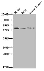 Western Blot
Positive WB detected in: HL-60 whole cell lysate, Hela whole cell lysate, Mouse kidney tissue
All lanes: OS9 antibody at 1:2000
Secondary
Goat polyclonal to rabbit IgG at 1/50000 dilution
Predicted band size: 76, 70, 68, 74, 66, 64, 70, 61 kDa
Observed band size: 72-95 kDa